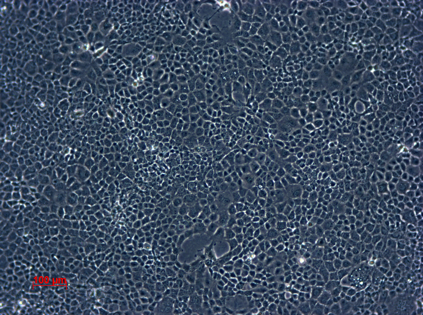 BNL CL.2细胞图片